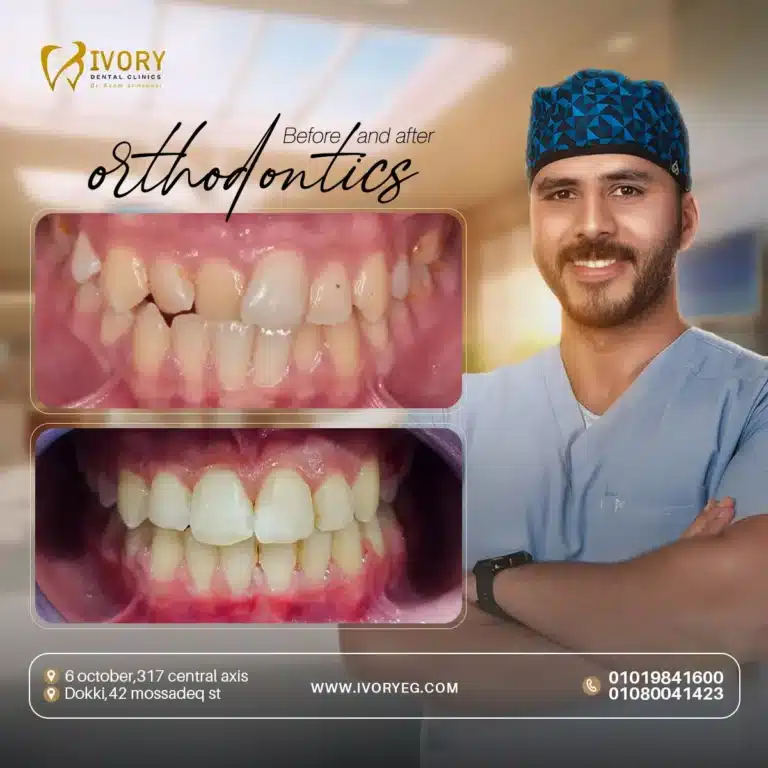 braces