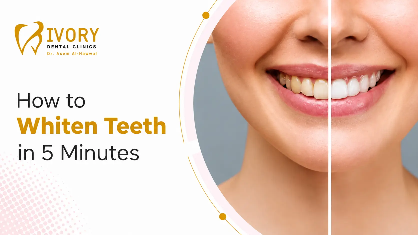 How to Whiten Teeth in 5 Minutes How to Whiten Teeth in 5 Minutes