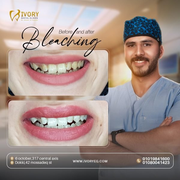 Cosmetic dentistry